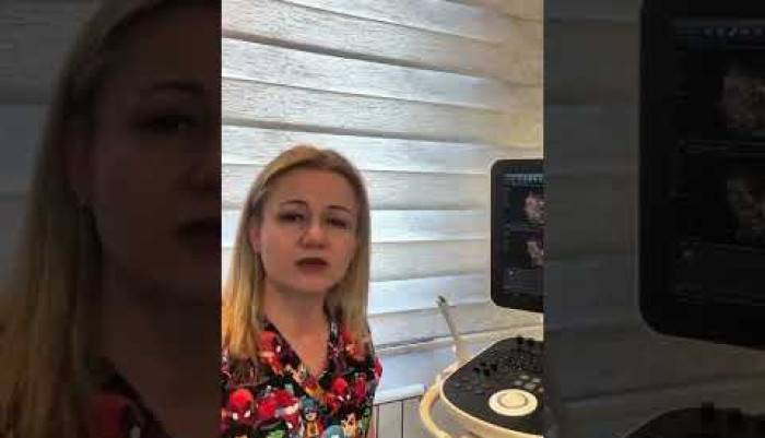 #Sarp,Karataş,#nerf